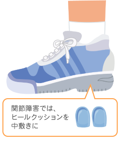 スニーカー 関節障害では、ヒールクッションを中敷きに