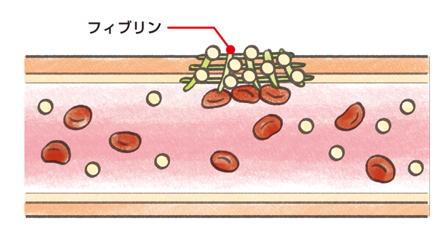 正常な場合