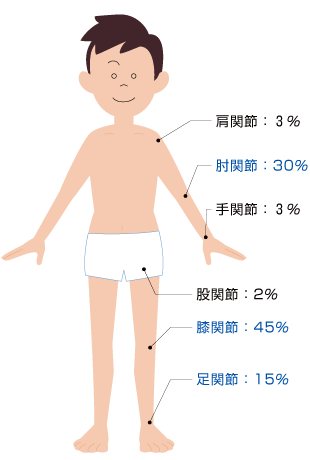 関節内出血の主な部位